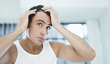 Man-Hairloss Man-Hairloss